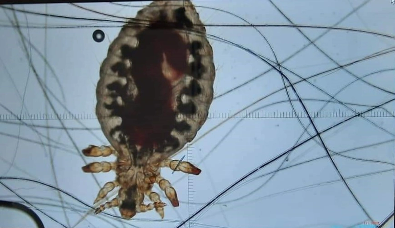 Mikroskopisches Bild eines Insekts
